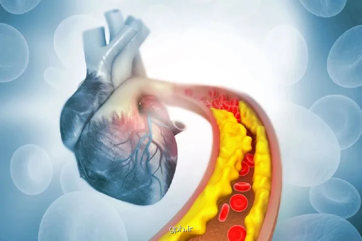 کاهش چربی خون با کمک ویرایش ژن برای بار اول