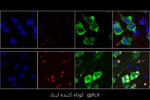 كشف یك نشانه جدید از پیر شدن نورون ها