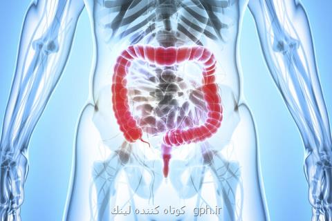 تشخیص سرطان روده بزرگ فقط با یك آزمایش خون!
