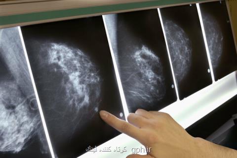 تشخیص سرطان پستان ۵ سال زودتر از ابتلا!