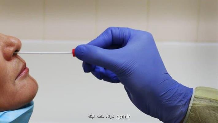 استفاده اضطراری كیت خانگی تشخیص كرونا تایید شد